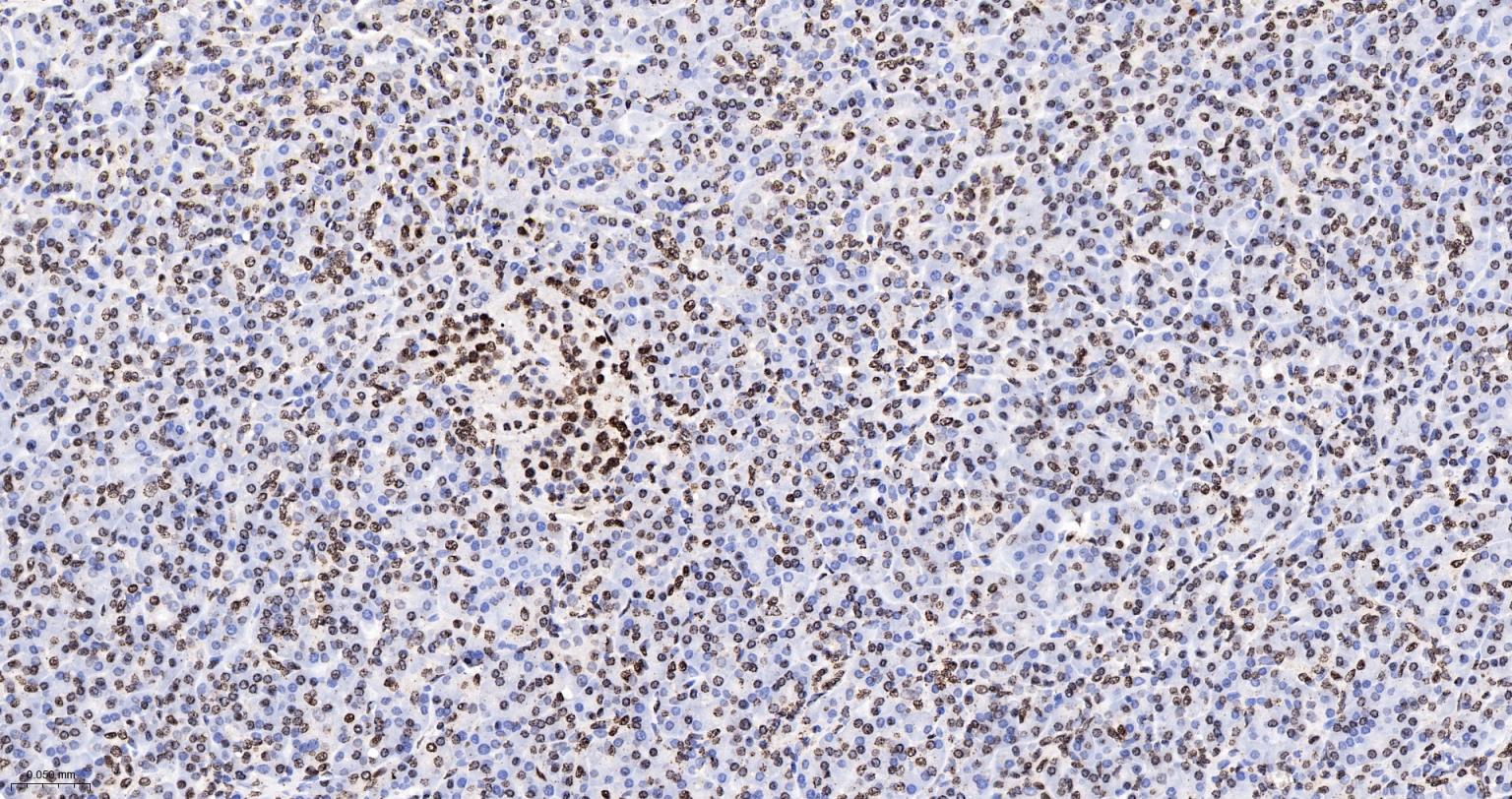 组蛋白H4重组兔单抗