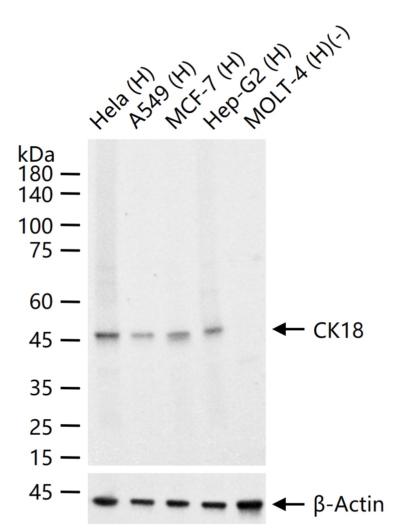 CK18 Mouse mAb (一抗) - WB,IHC-P,IHC-F,IF,Flow-Cyt,ICC/IF | Bioss