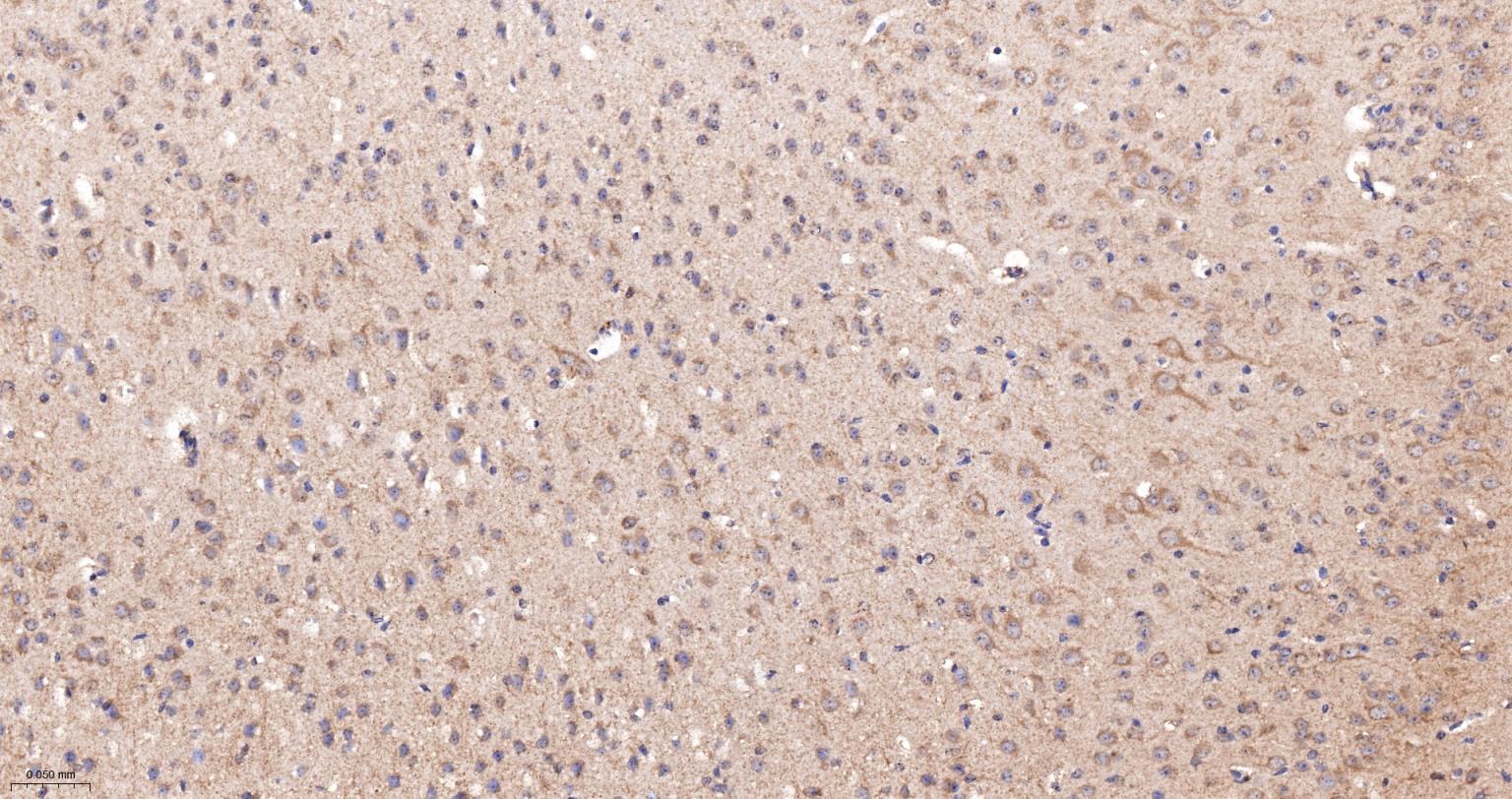 蛋白激酶AKT底物1重组兔单抗-bsm-61149R