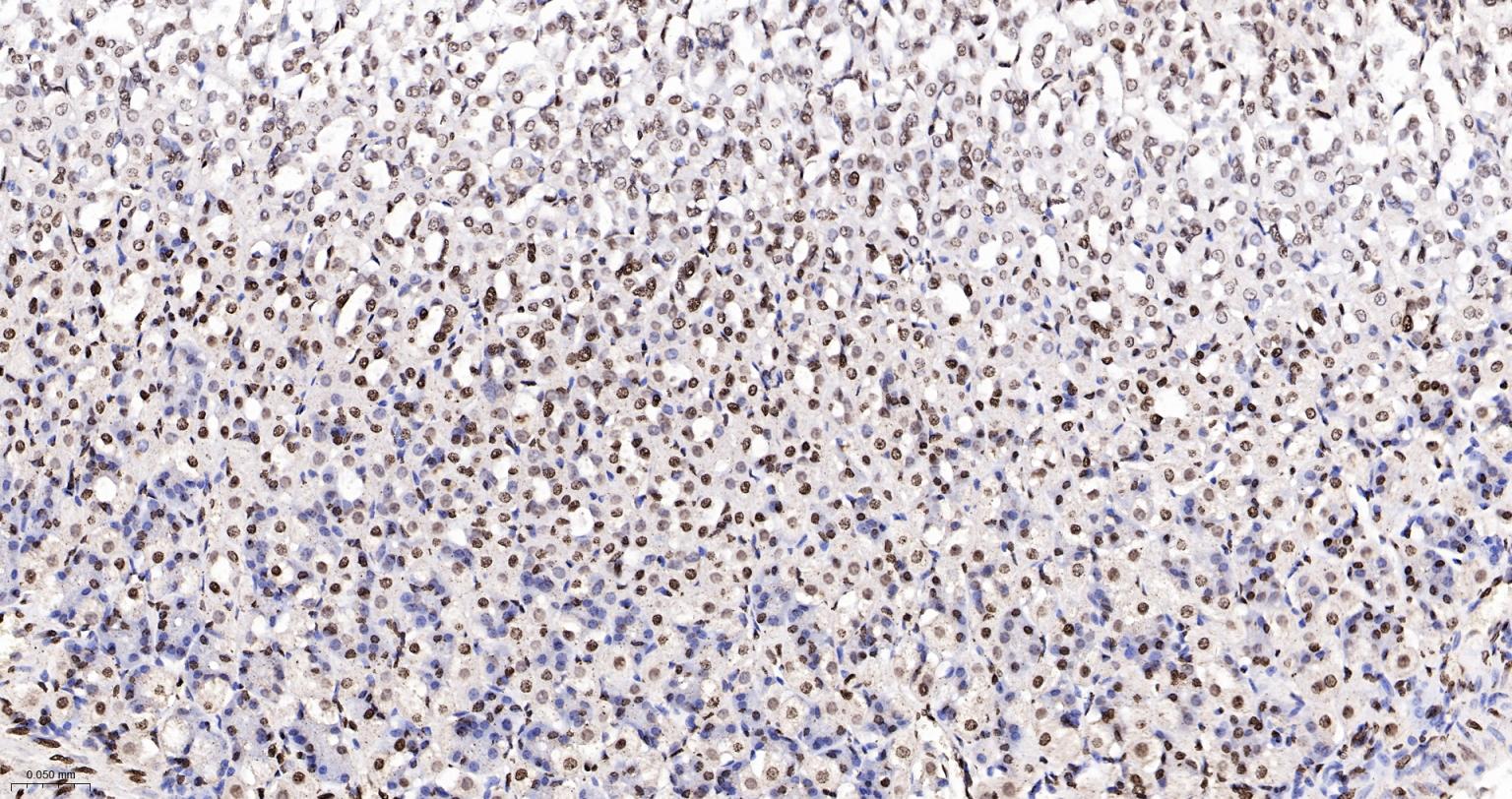 组蛋白H4重组兔单抗