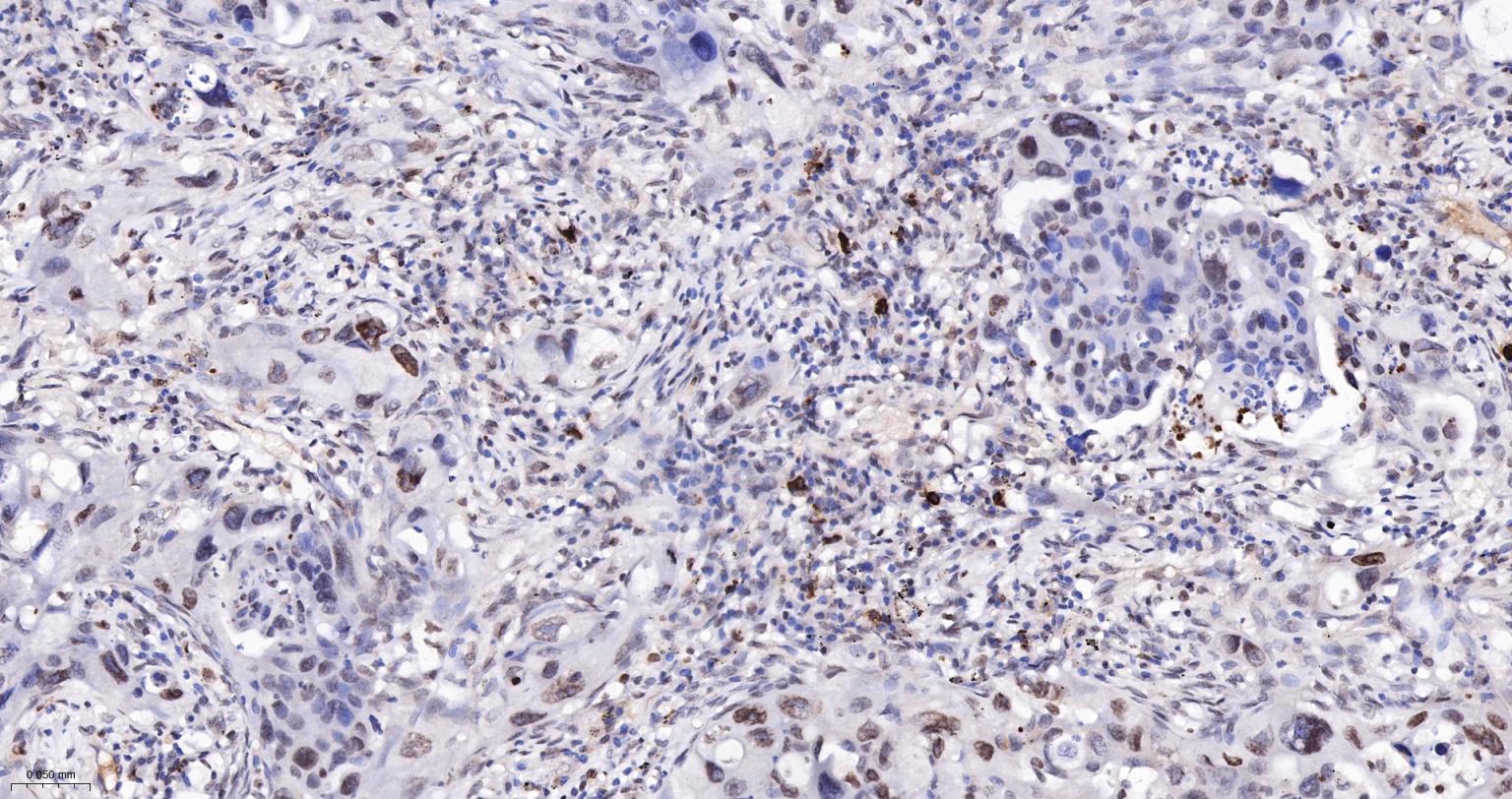 双链RNA腺苷酸脱氨基酶重组兔单抗