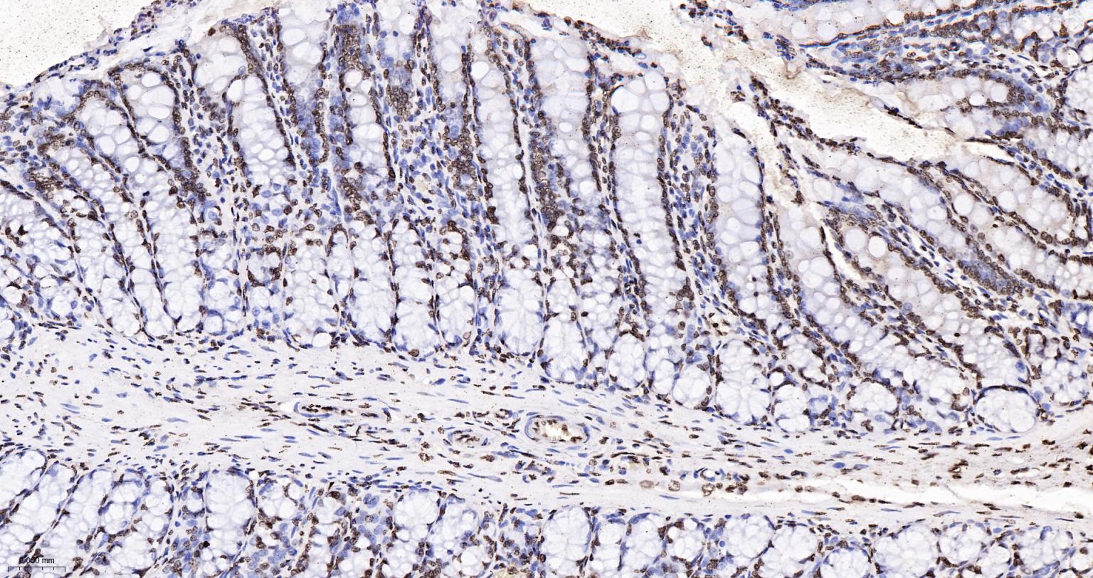 组蛋白H4重组兔单抗