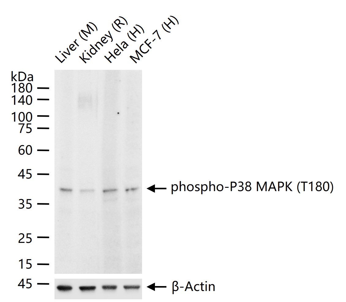 磷酸化p38MAPK重组兔单抗