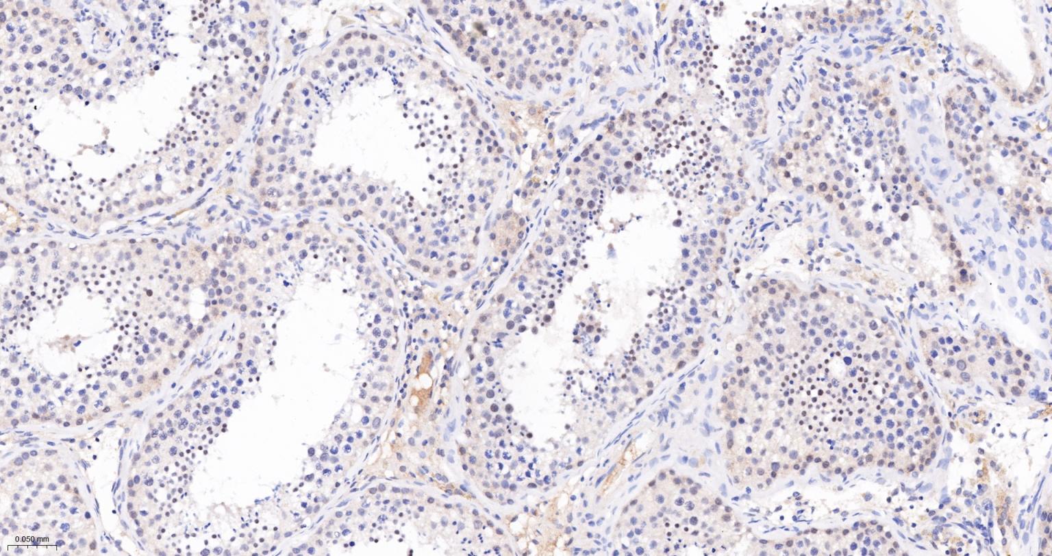 Jun激活区域-连接蛋白1重组兔单抗