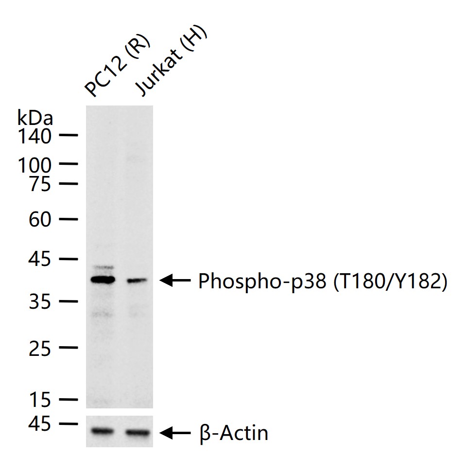 磷酸化p38 MAPK重组兔单抗