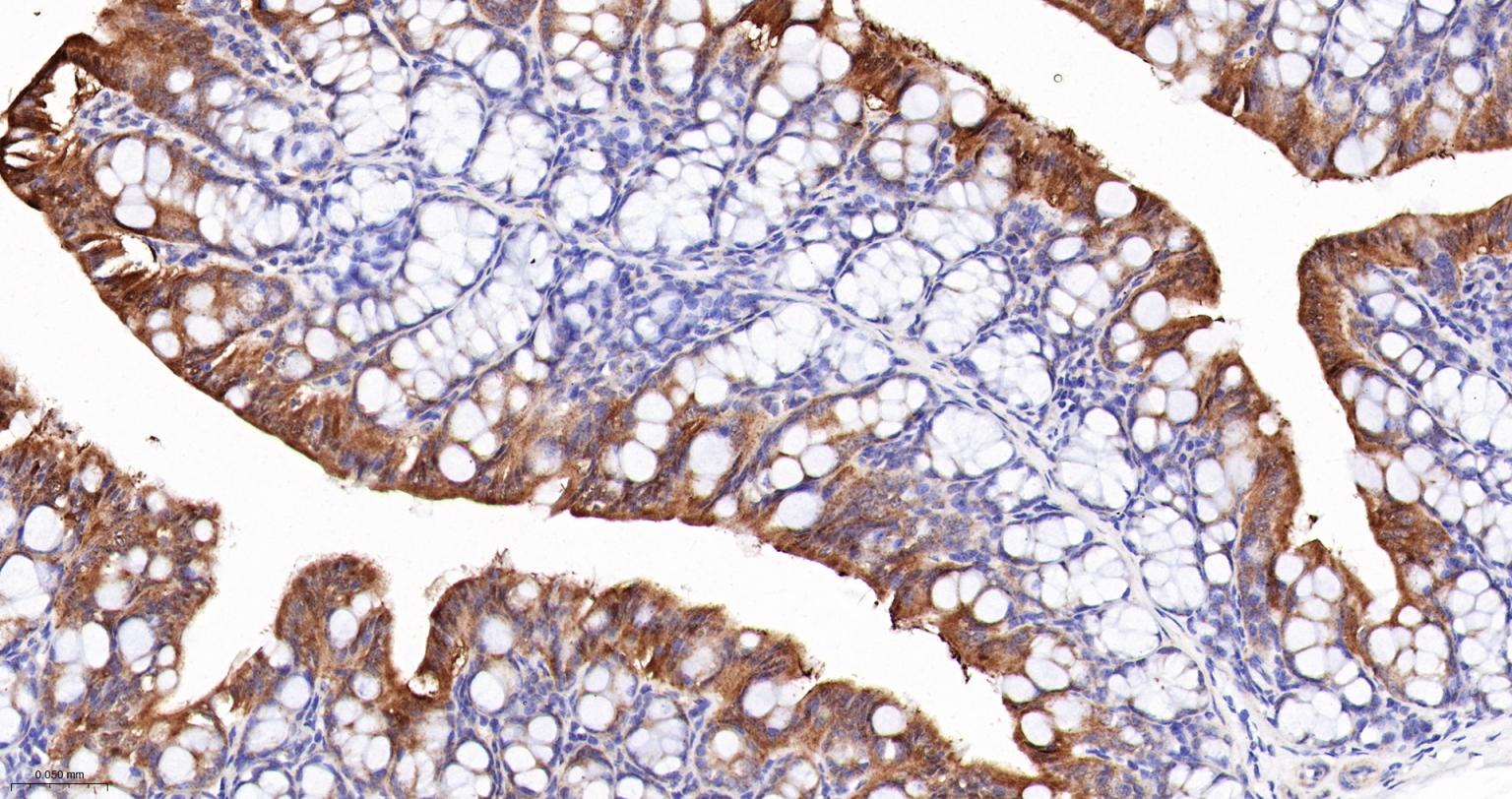 ALKBH1蛋白重组兔单抗