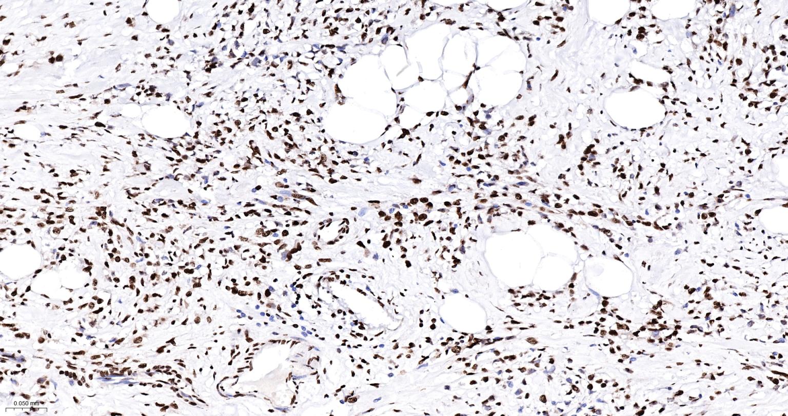 皮层肌动蛋白重组兔单抗