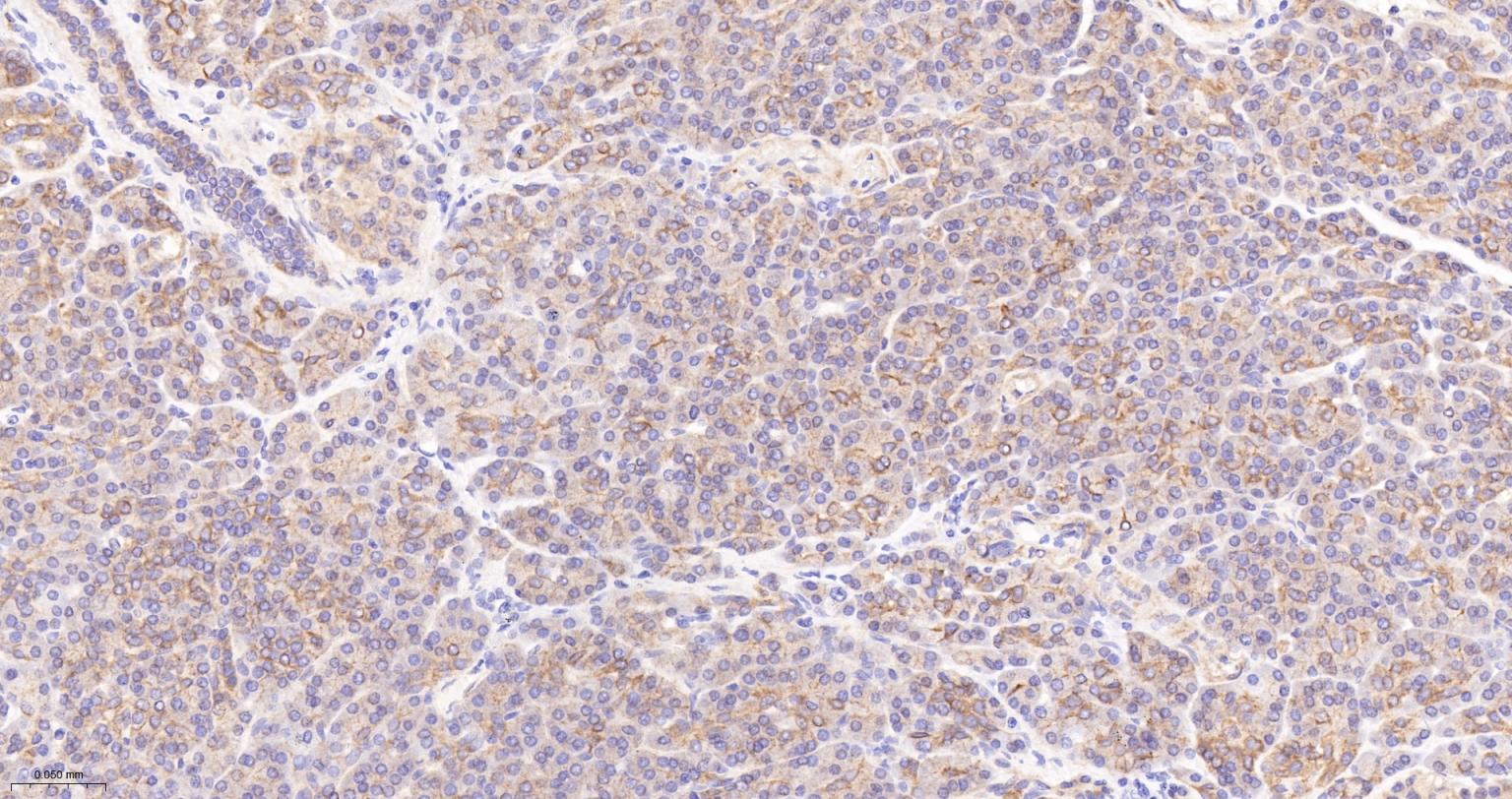 皮层肌动蛋白重组兔单抗