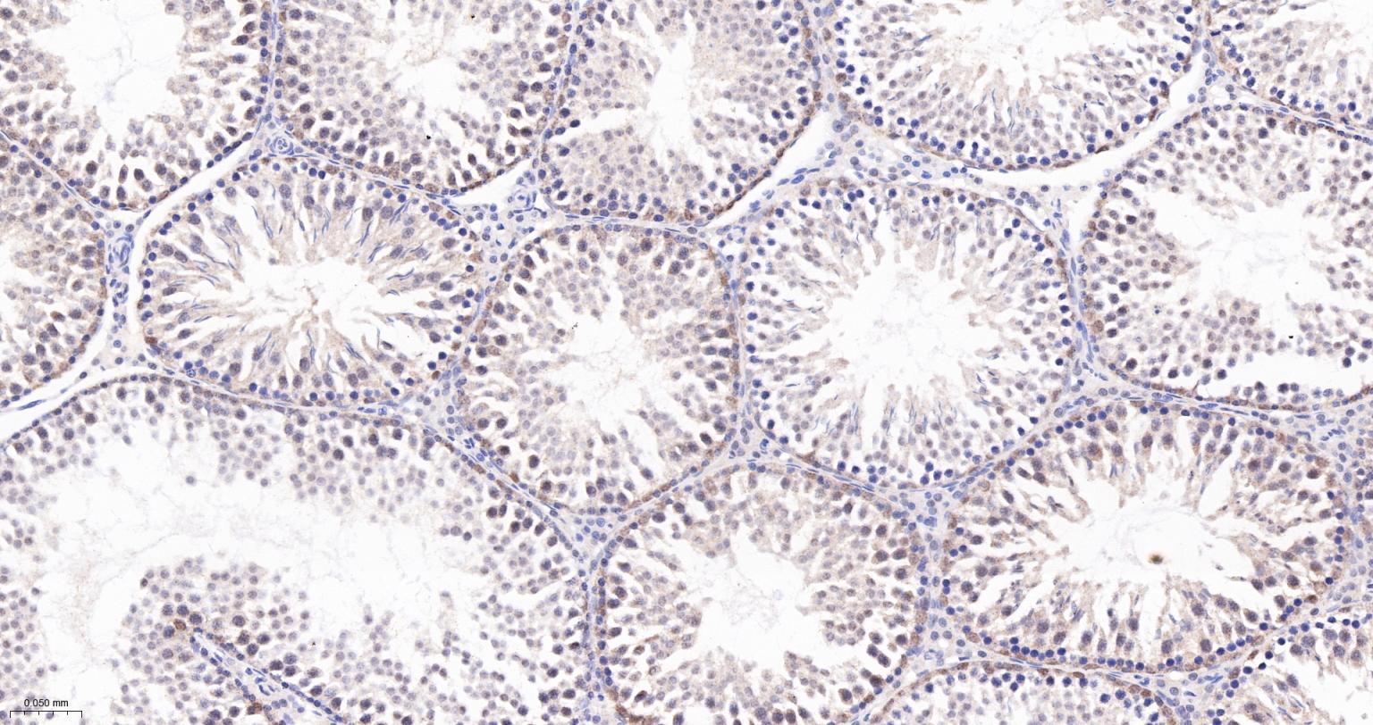 Jun激活区域-连接蛋白1重组兔单抗