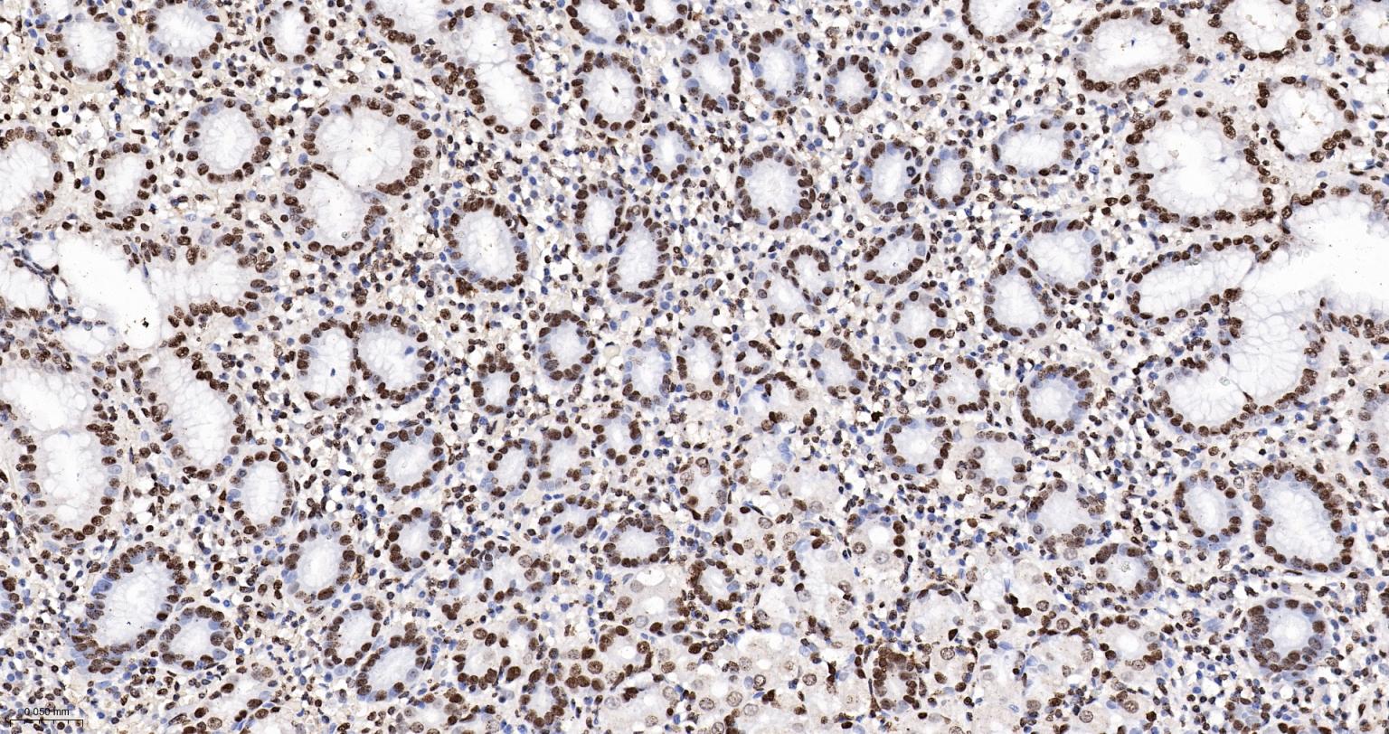 组蛋白H4重组兔单抗