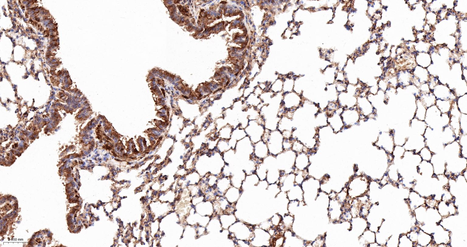 AKT1S1 Recombinant Rabbit mAb (一抗) - IHC-P,IHC-F,IF,Flow-Cyt,ICC/IF,IP | Bioss