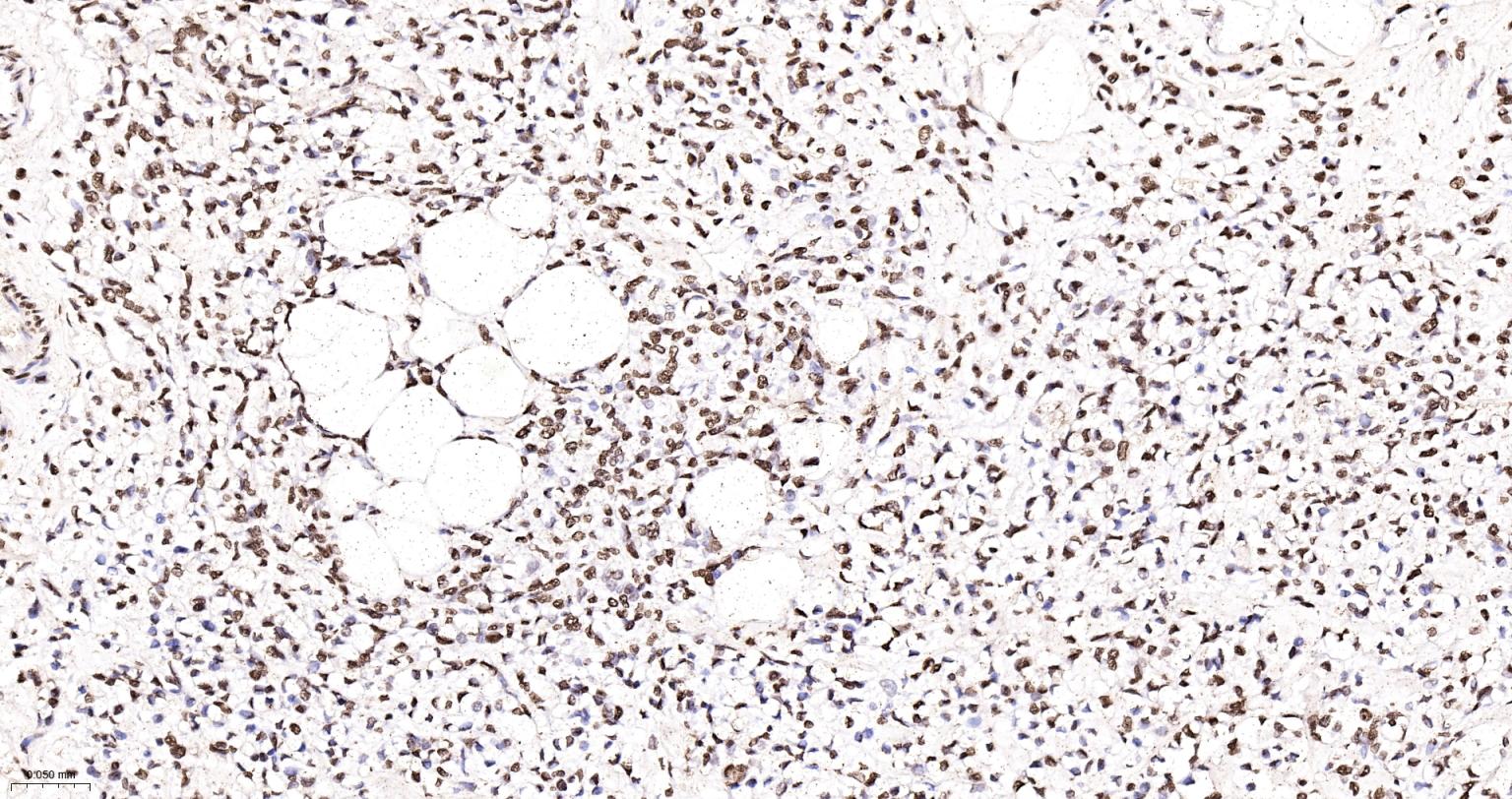组蛋白H4重组兔单抗
