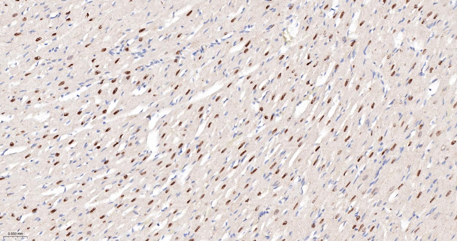 丝/苏氨酸蛋白质激酶II α重组兔单抗