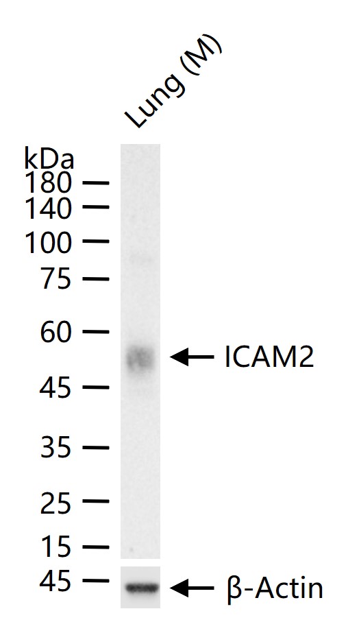 细胞间粘附分子-2（CD102）重组兔单抗