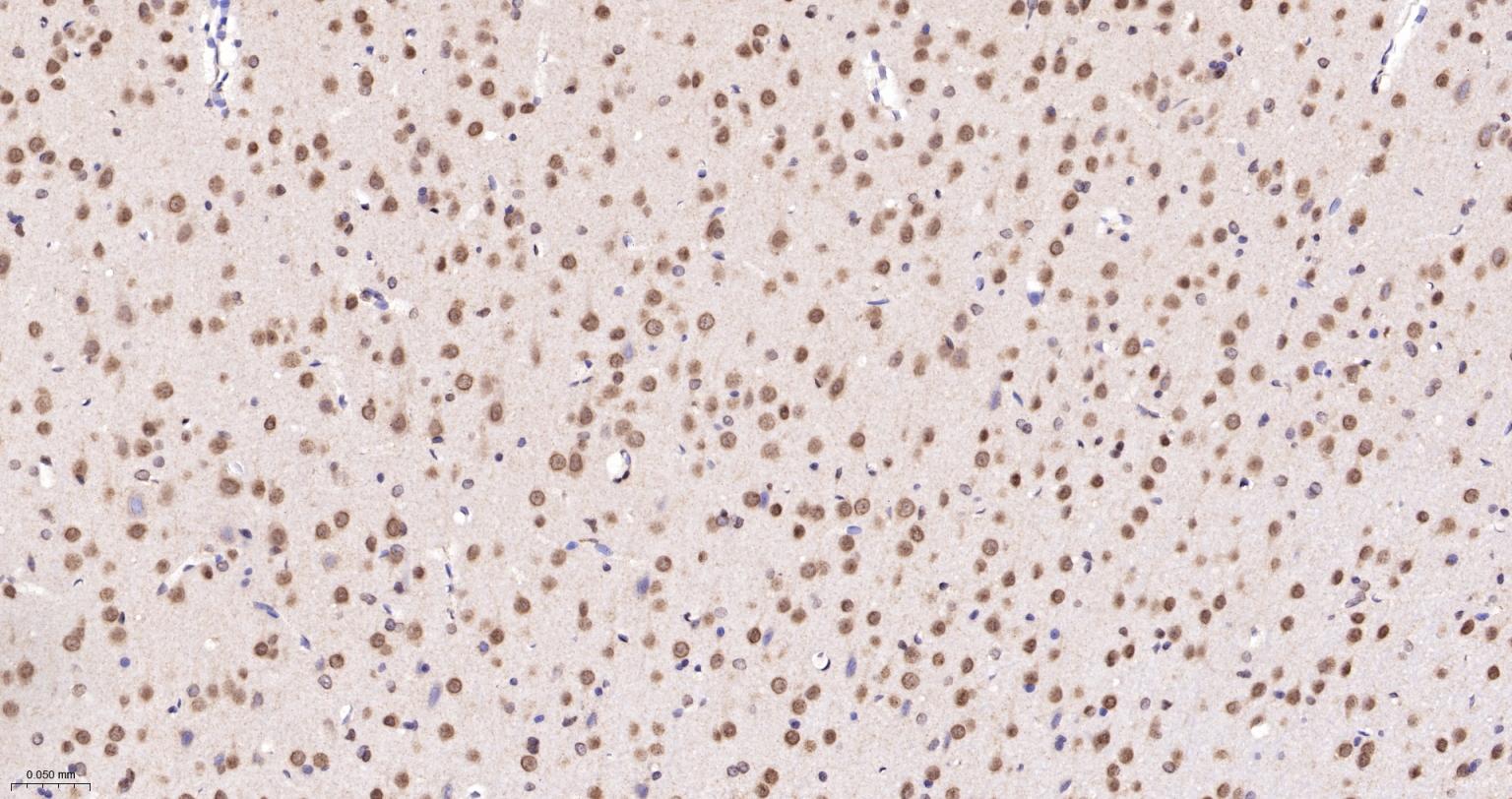 泛素蛋白连接酶E2I重组兔单抗