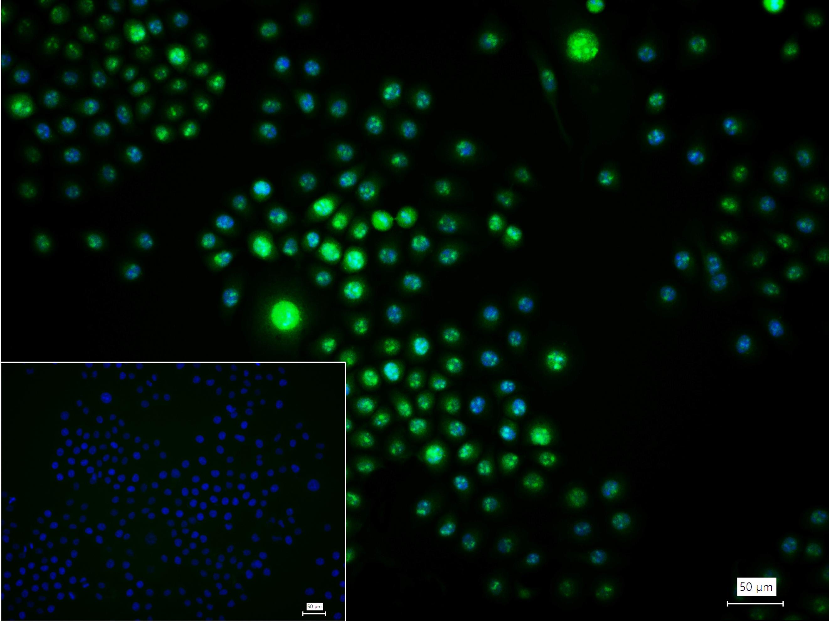 白细胞介素增强子结合因子2重组兔单抗