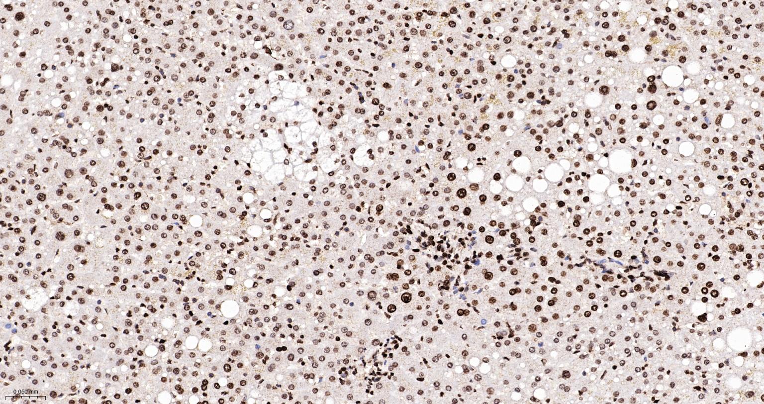 组蛋白H4重组兔单抗