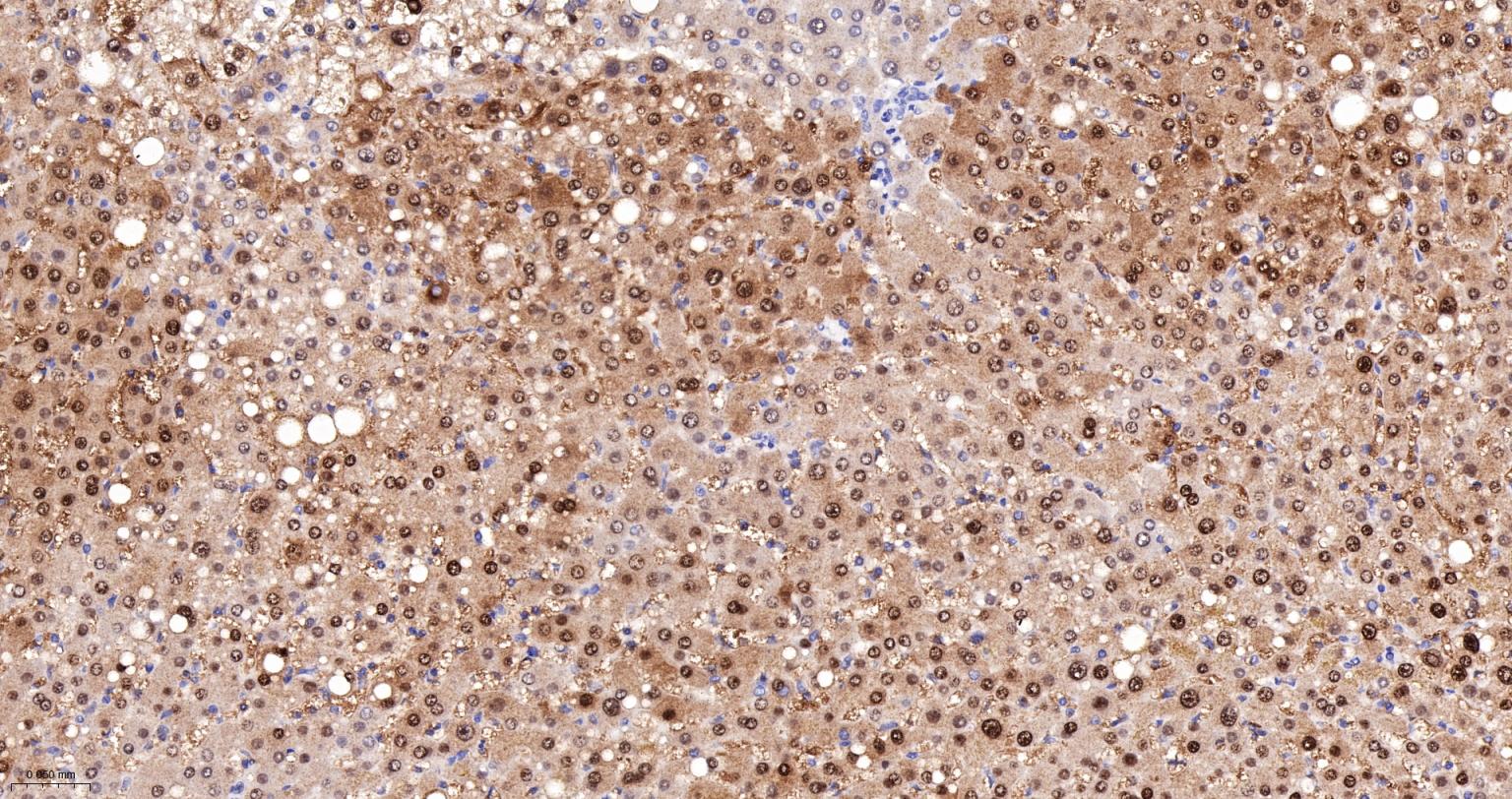 ALKBH1蛋白重组兔单抗