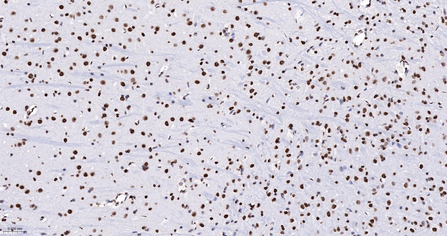 组蛋白H4重组兔单抗