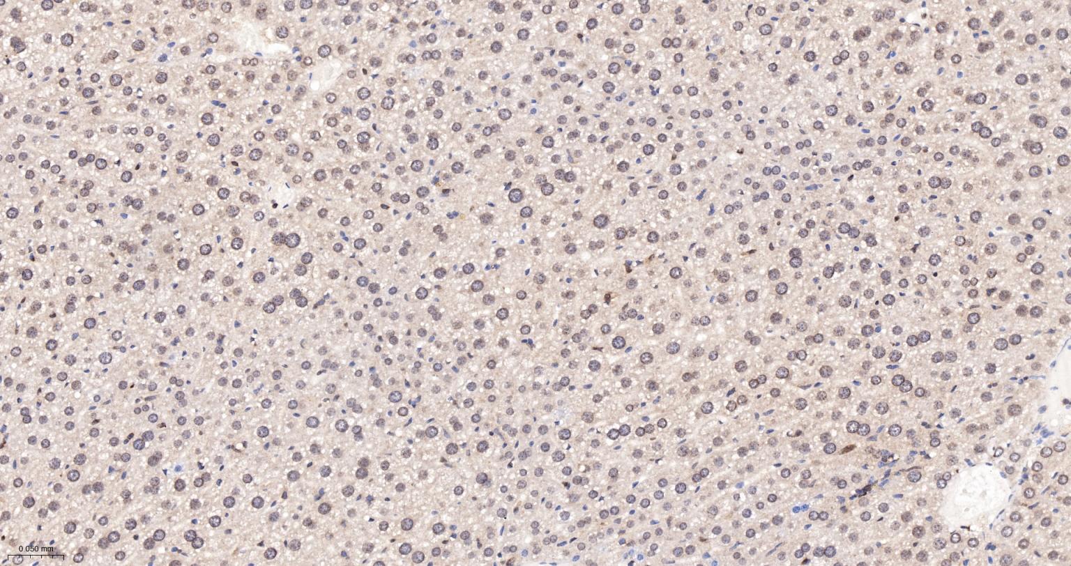 泛素蛋白连接酶E2I重组兔单抗