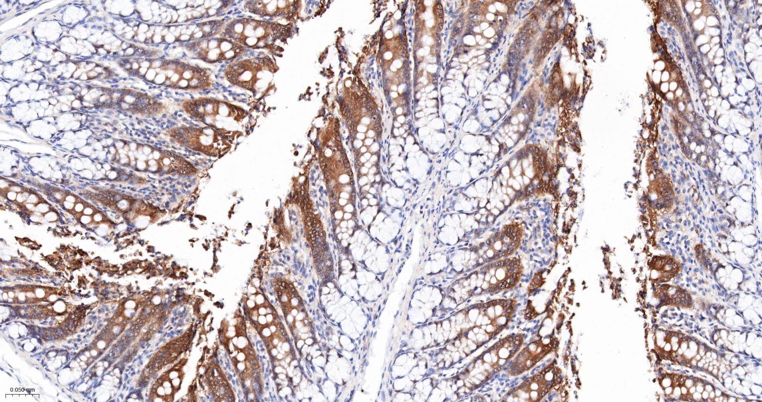 ALKBH1蛋白重组兔单抗