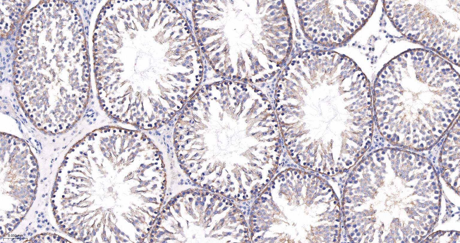 皮层肌动蛋白重组兔单抗