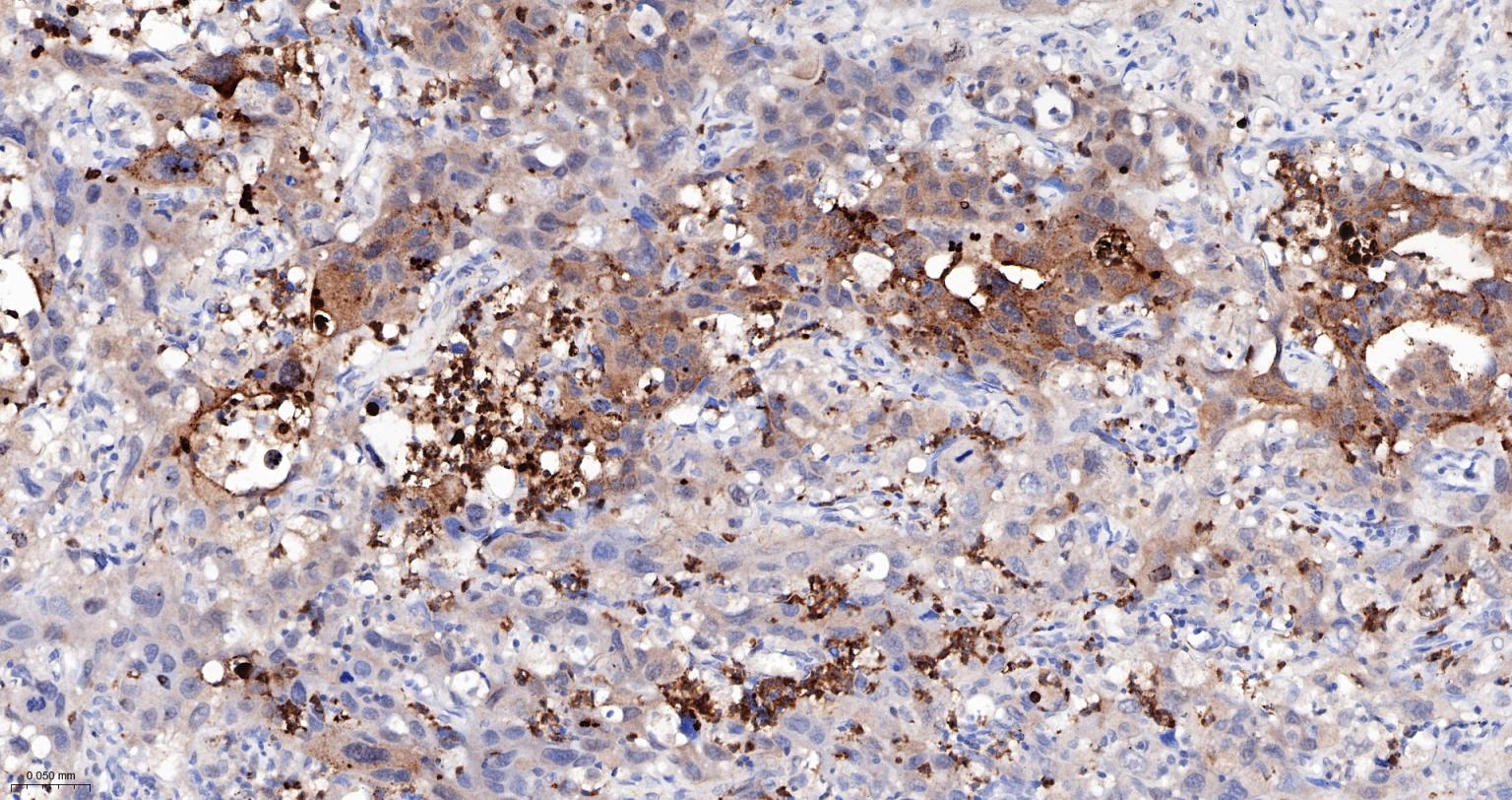 Caspase-6重组兔单抗
