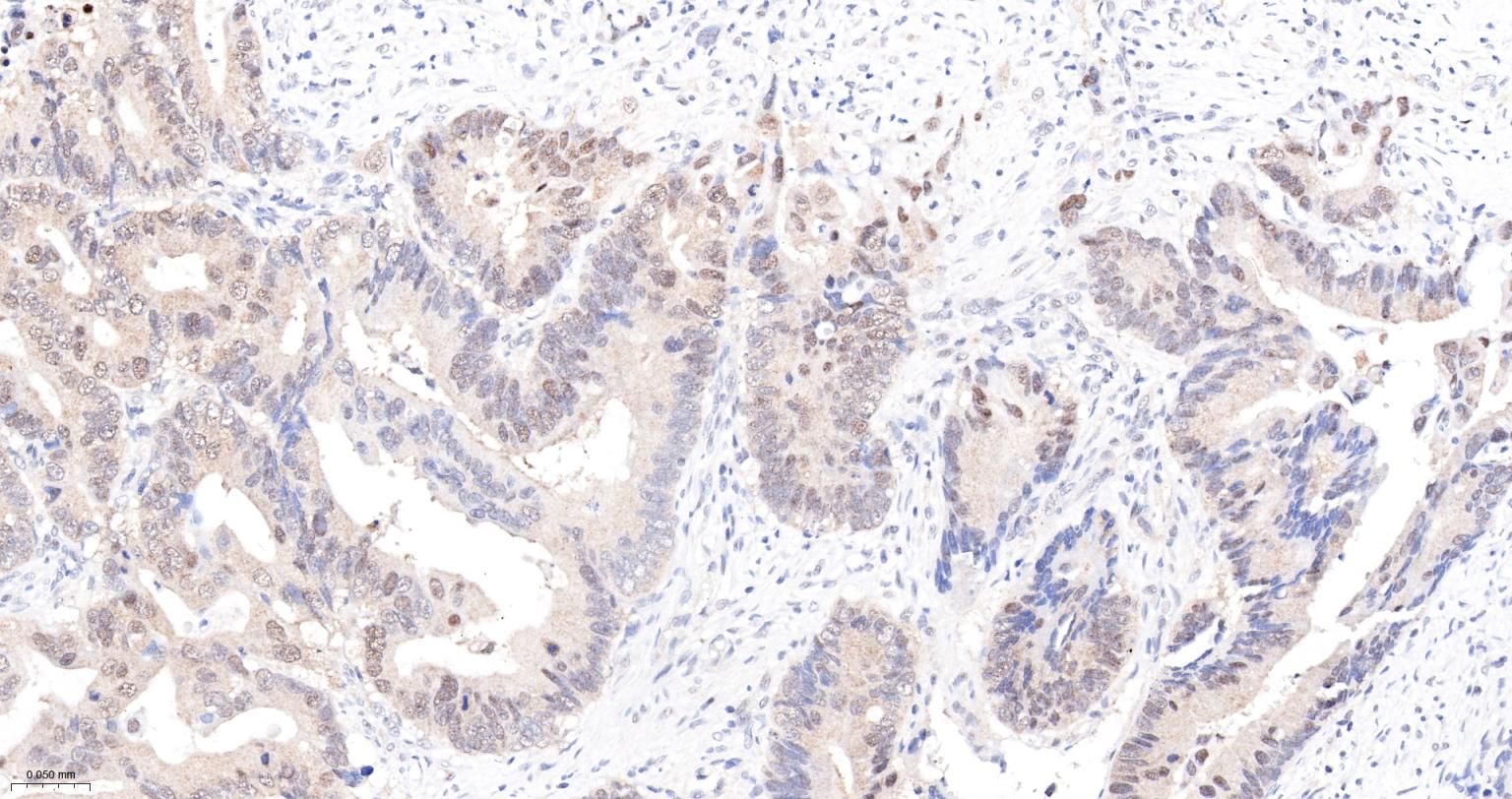 丝/苏氨酸蛋白质激酶II α重组兔单抗