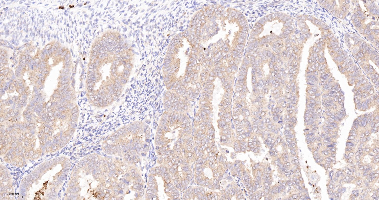 Ras GTP酶活化蛋白结合蛋白1重组兔单抗
