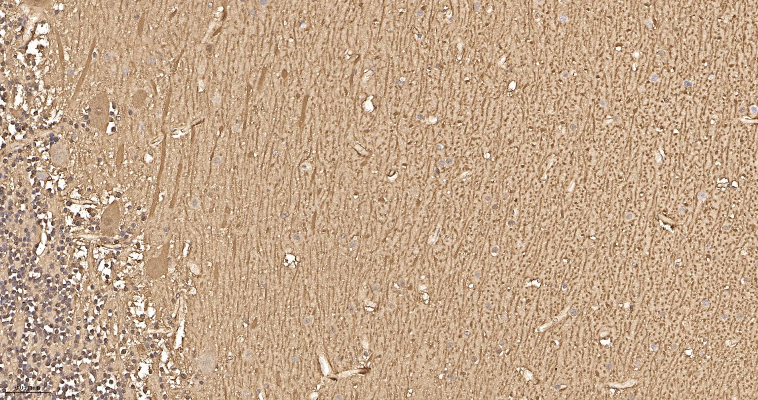 钙结合蛋白D28K重组兔单抗