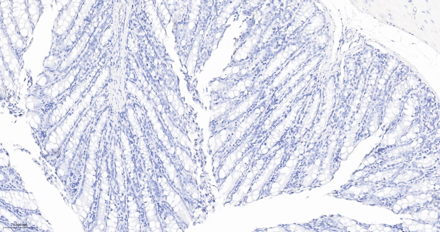 细胞角蛋白5重组兔单抗