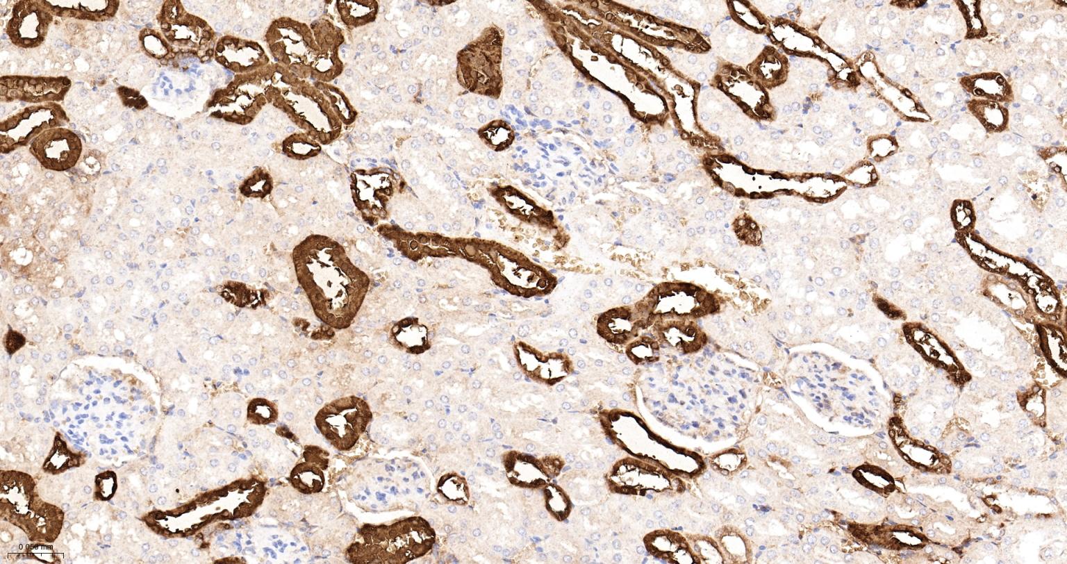 钙结合蛋白D28K重组兔单抗