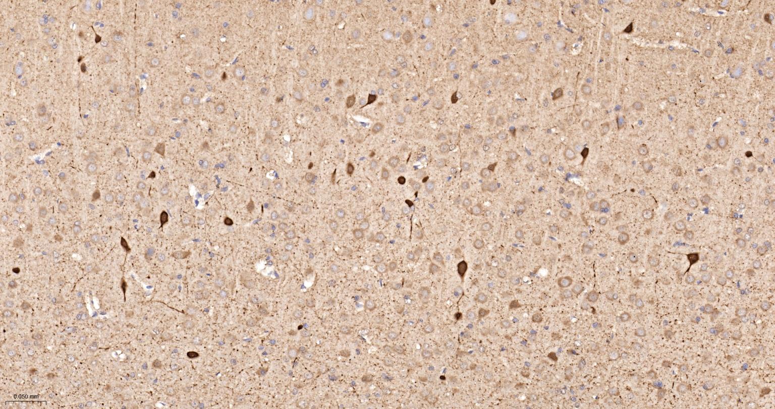 钙结合蛋白D28K重组兔单抗