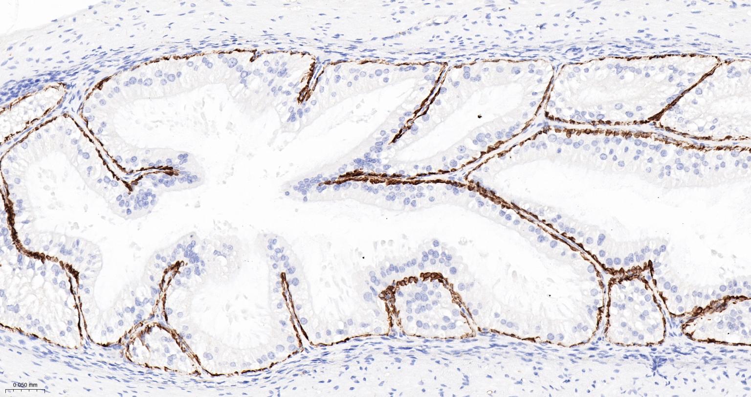 细胞角蛋白5重组兔单抗