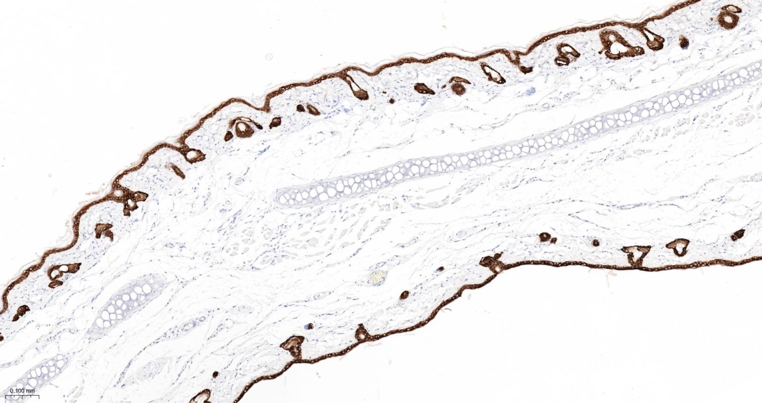 细胞角蛋白5重组兔单抗