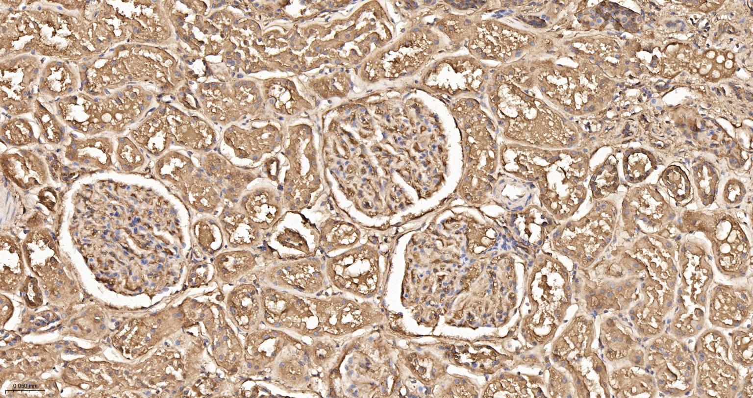 钙结合蛋白D28K重组兔单抗