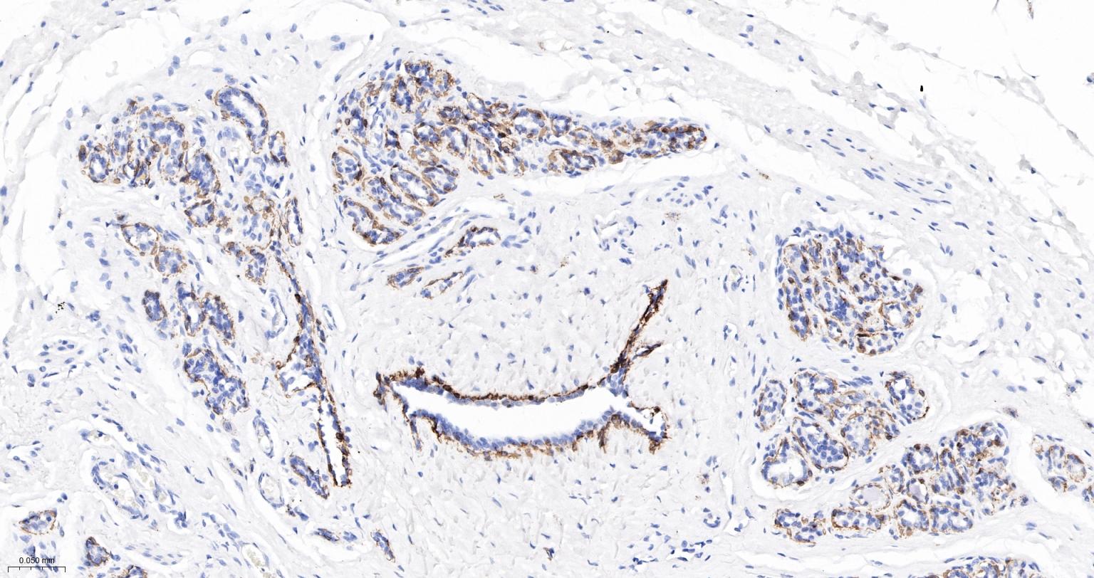 细胞角蛋白5重组兔单抗