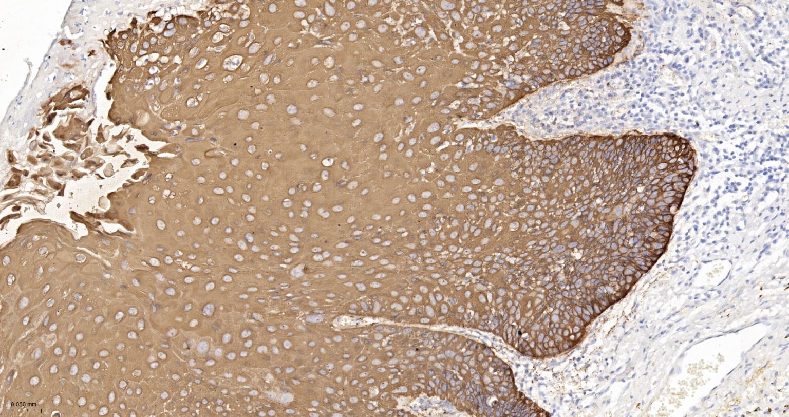 细胞角蛋白5重组兔单抗