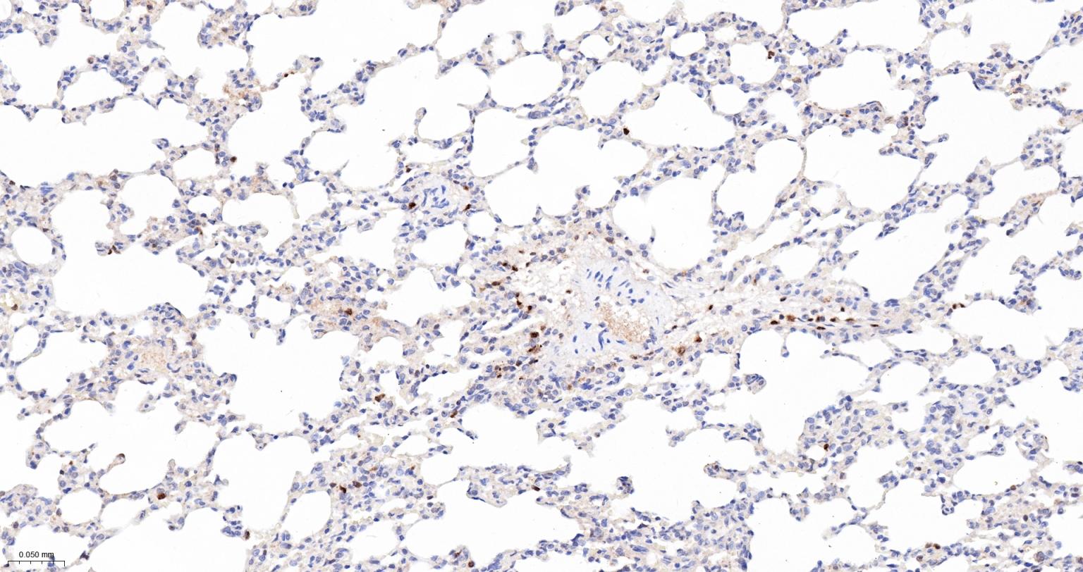活化半胱胺酸蛋白酶蛋白-3重组兔单抗