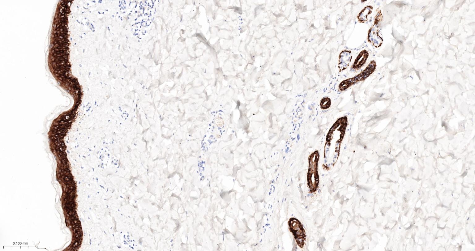 细胞角蛋白5重组兔单抗