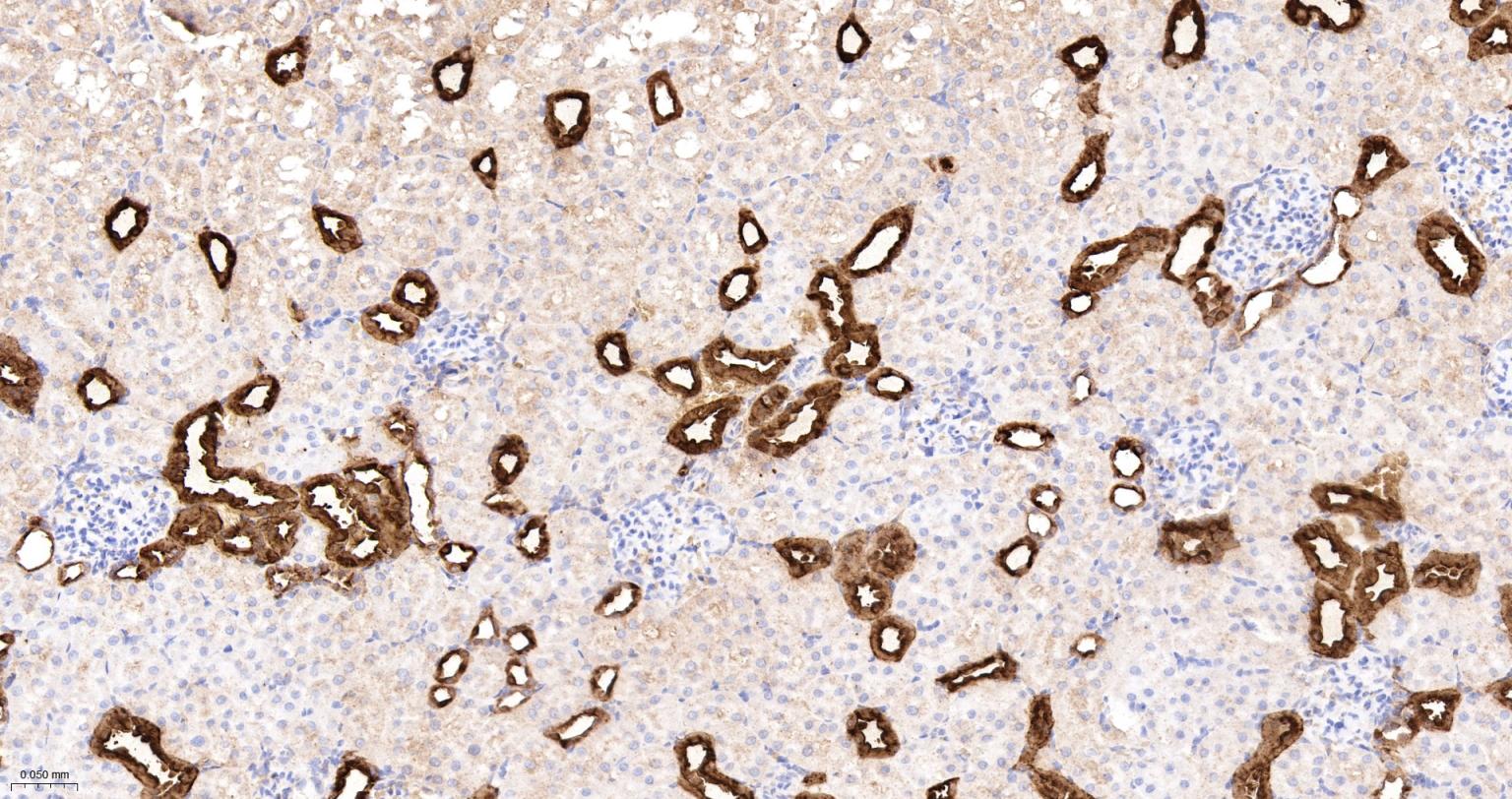 钙结合蛋白D28K重组兔单抗