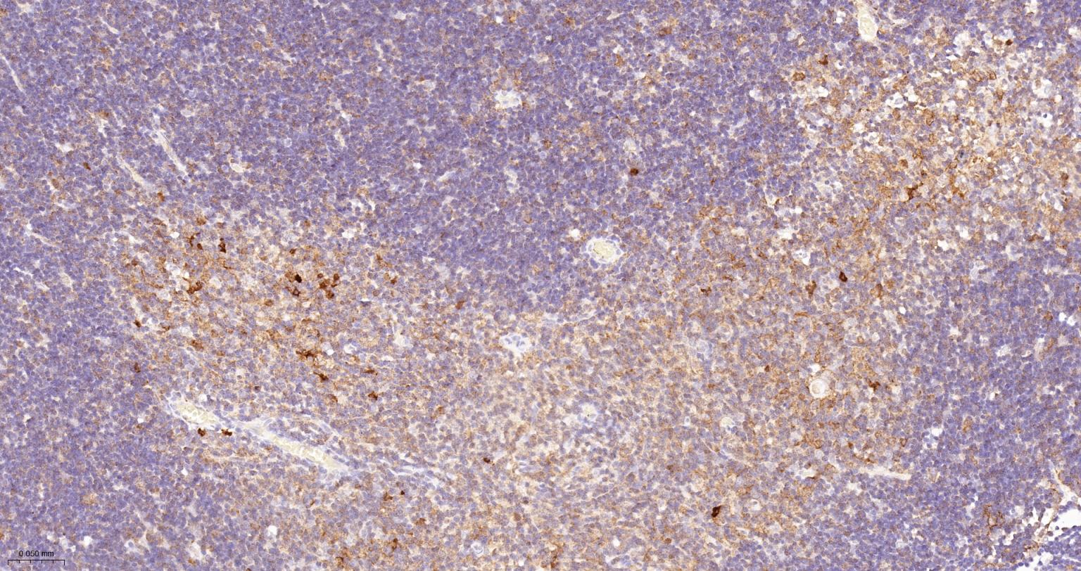 活化半胱胺酸蛋白酶蛋白-3重组兔单抗