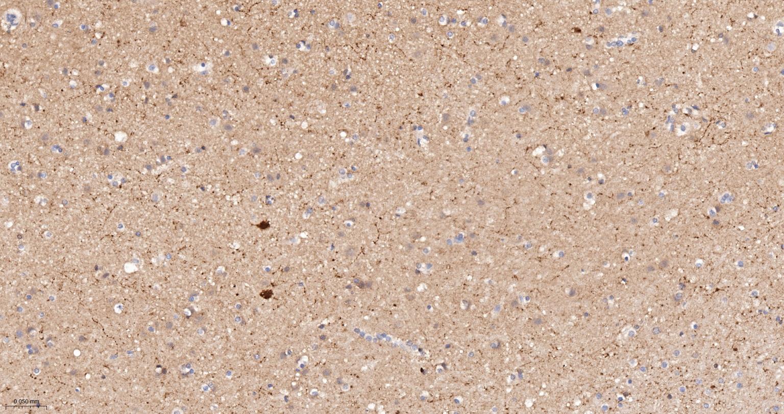 钙结合蛋白D28K重组兔单抗