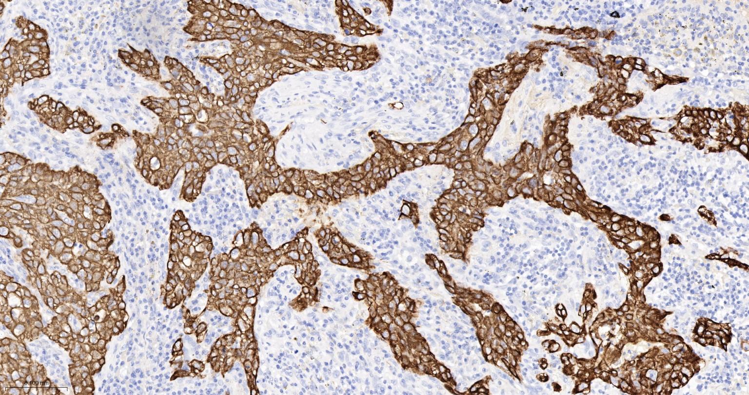 细胞角蛋白5重组兔单抗