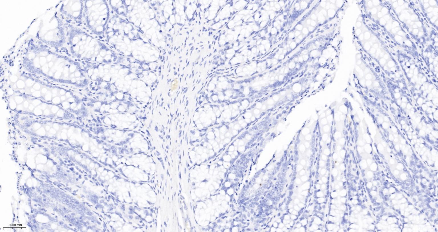 细胞角蛋白5重组兔单抗