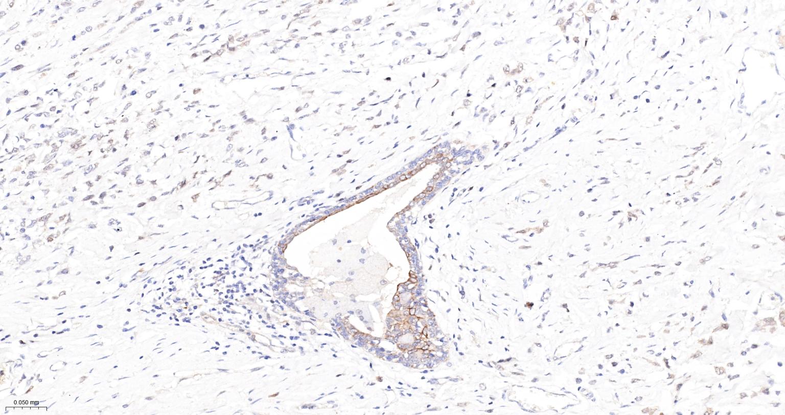 活化半胱胺酸蛋白酶蛋白-3重组兔单抗