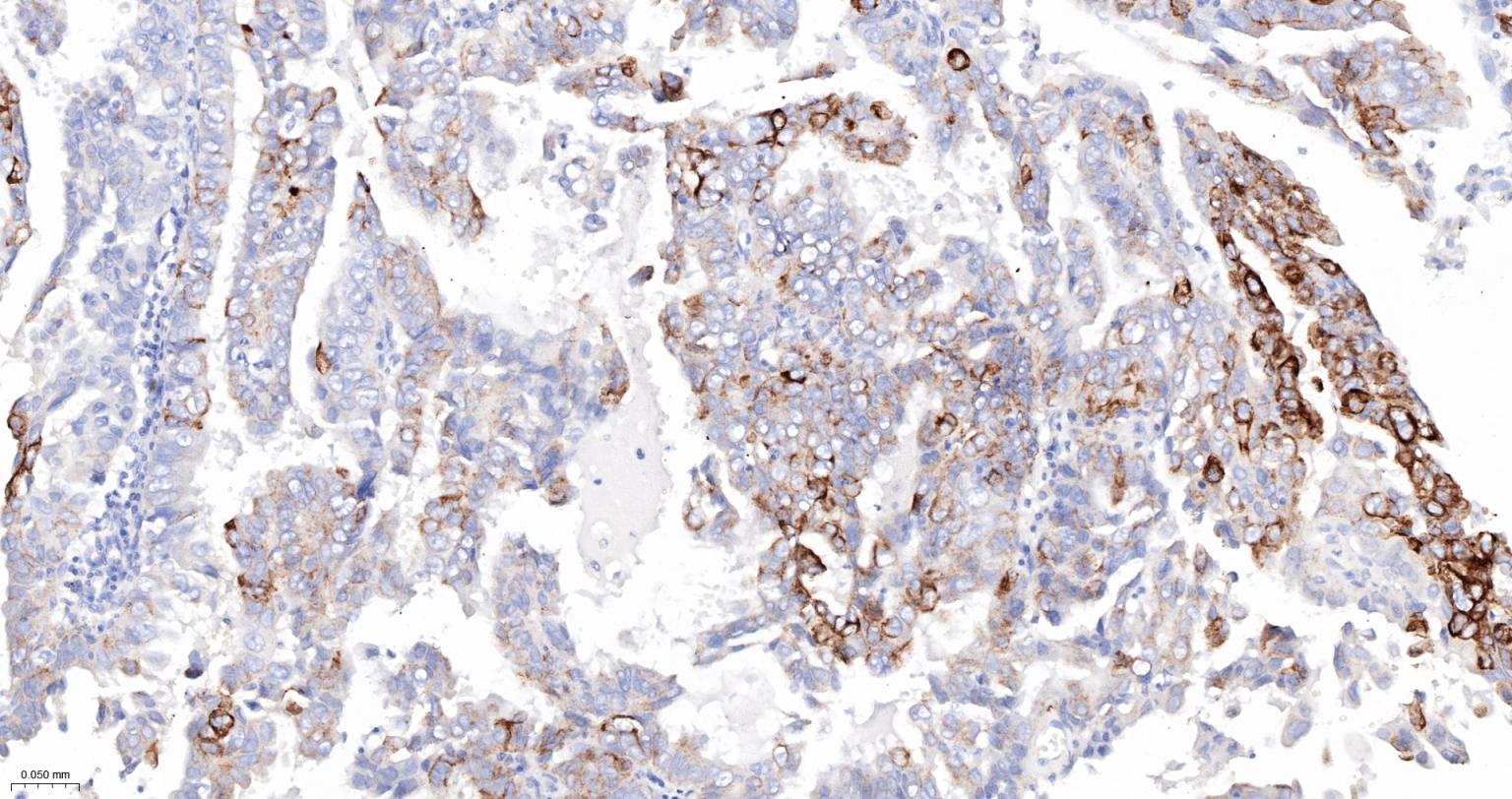 细胞角蛋白5重组兔单抗