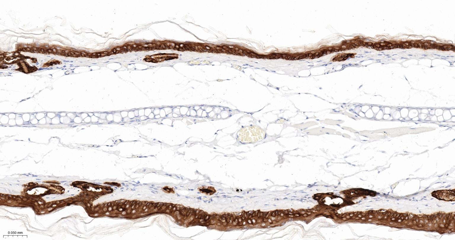 细胞角蛋白5重组兔单抗