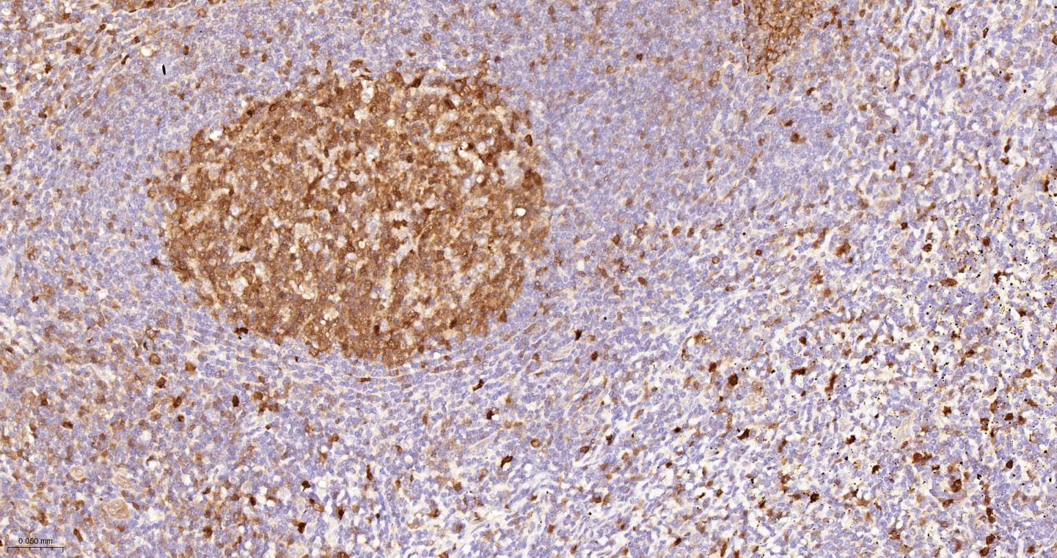 活化半胱胺酸蛋白酶蛋白-3重组兔单抗