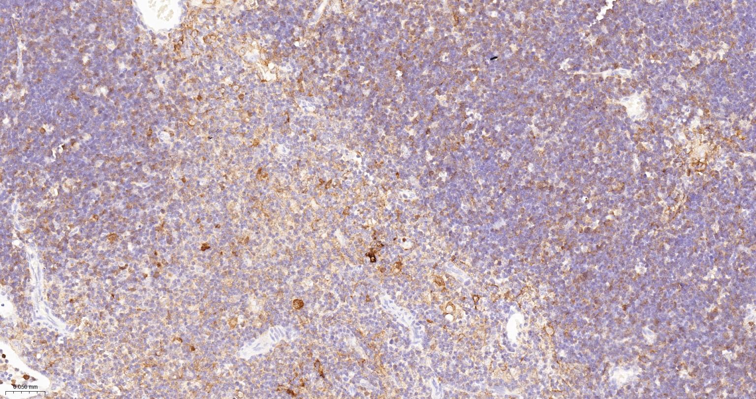 活化半胱胺酸蛋白酶蛋白-3重组兔单抗